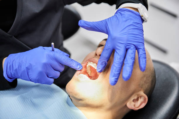 Best Emergency Wisdom Teeth Removal in Paris, TN